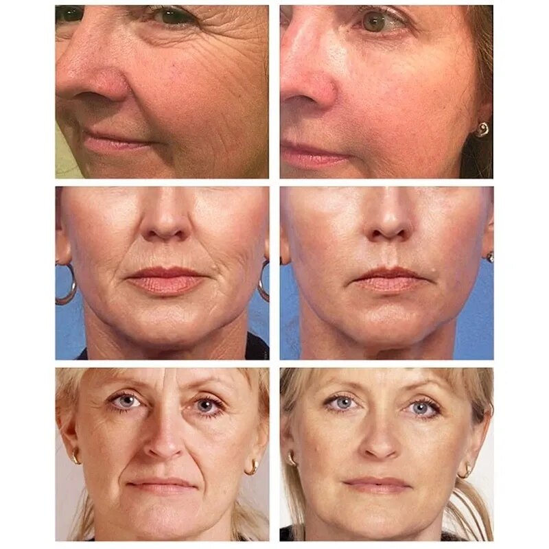 Anti Wrinkle Neck Cream Face Tightening Serum